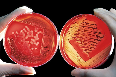 Permalink to:Eliciting Mucosal Immunity in Tuberculosis (EMI-TB)